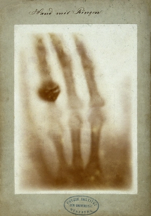 X-Ray — ranked #10